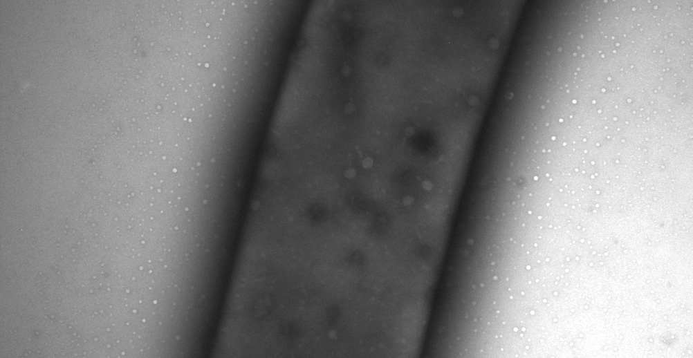 Umbc Phage Hunters Myumbc